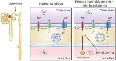 Dissecting the Effects of Aldosterone and Hypokalemia on the Epithelial Na+ Channel and the NaCl Cotransporter